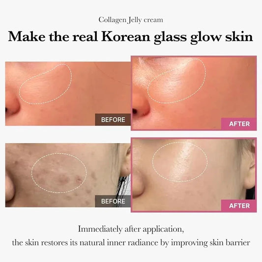 Collagen Jelly Face Cream (100g) – Hydrating, Pore-Refining & Nourishing Korean Skincare