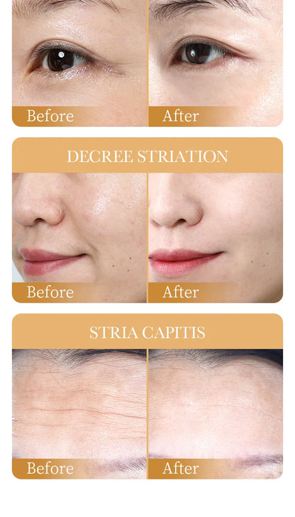 10PCS Collagen Anti-Wrinkle Facial Masks – Anti-Aging, Moisturizing & Firming Korean Skincare