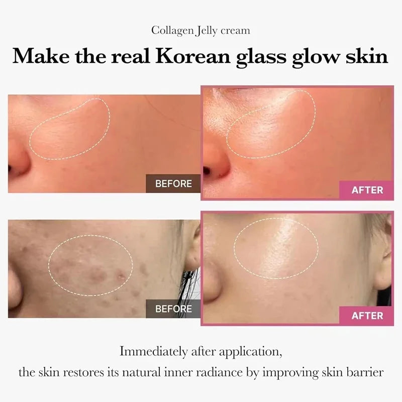 Collagen Jelly Face Cream (100g) – Hydrating, Pore-Refining & Nourishing Korean Skincare